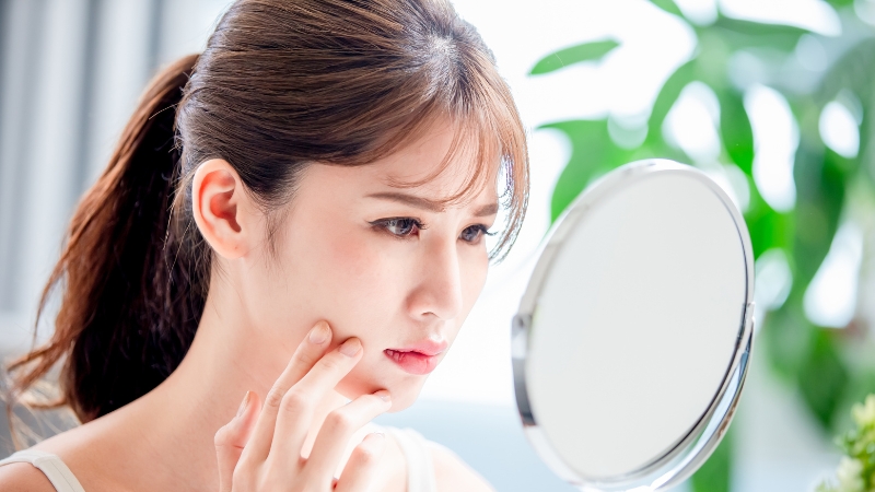 da dầu mụn là tình trạng da cực kỳ phổ biến với biểu hiện dễ nhận biết là da bóng như phủ một lớp dầu lên trên mặt