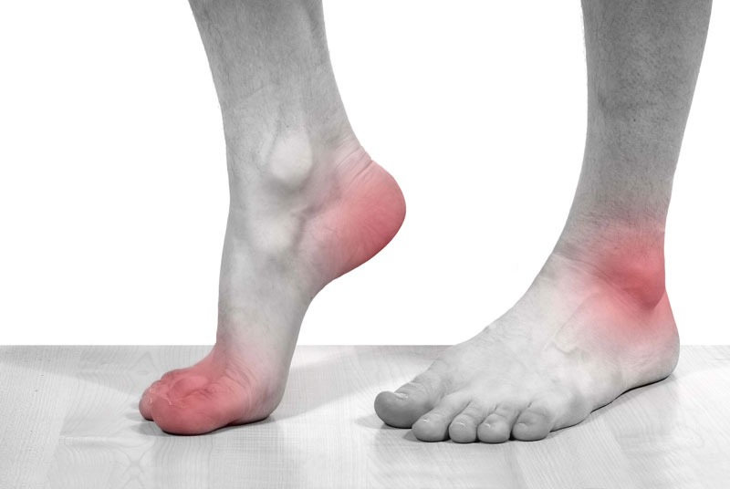 Bệnh Gout gây ra các cơn đau nhức vùng quanh khớp khiến người bệnh mất ngủ, mệt mỏi