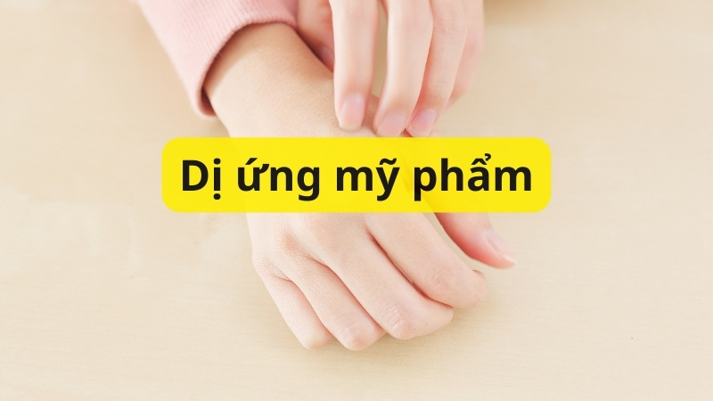 Dá ngứa, nổi mẩn là dấu hiệu dị ứng mỹ phẩm thường gặp