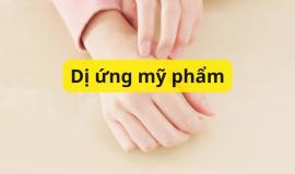 Bật mí cách trị dị ứng mỹ phẩm tại nhà nhanh nhất